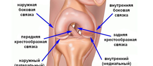 Цікаві випадки ендопротезування кульшового та колінного суглобів